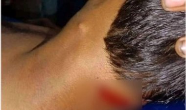 পটুয়াখালীতে আ’লীগ-স্বতন্ত্র প্রার্থীর সমর্থকদের সংঘর্ষে আহত ১০