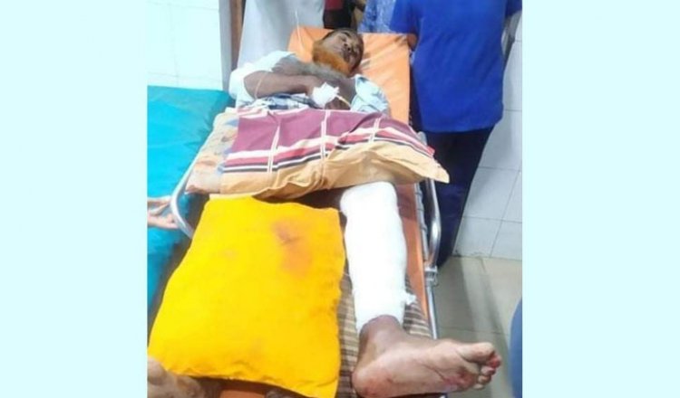 মাদারীপুরে কৃষকের পায়ের রগ কেটে দিলো দুর্বৃত্তরা