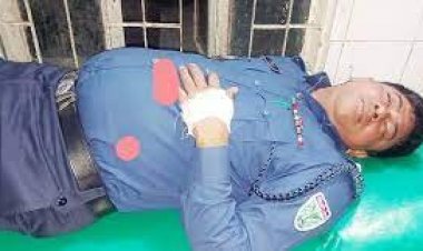 দুই প্রার্থীর সমর্থকদের সংঘর্ষে ওসিসহ আহত ৪০