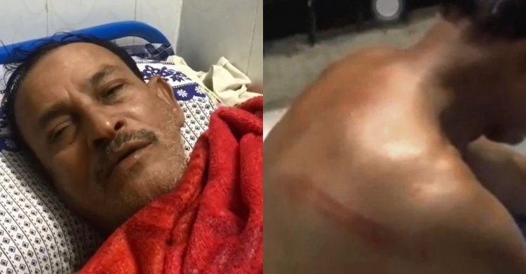 বাবার নির্বাচন না করায় বীর মুক্তিযোদ্ধাকে পেটালেন ছেলে
