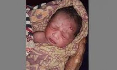 ফরিদপুরে সিজার করলেন আয়া-নার্স, নবজাতকের কপালে ৯ সেলাই