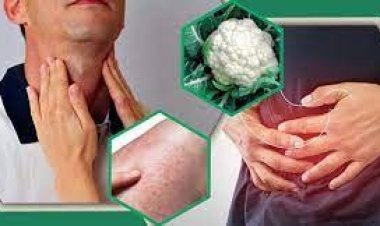 যাদের ফুলকপি খাওয়া উচিত নয়