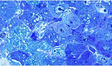 লাসা ভাইরাসে ব্রিটেনে ৩ মৃত্যু, মহামারির শঙ্কা