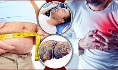 স্থূলতা যে ৯ রোগের কারণ