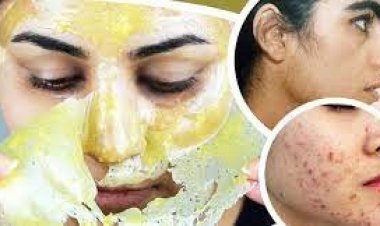 মুখের কালো দাগ ও লোম তুলতে যেভাবে মাখবেন ডাল