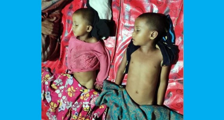 ‘জ্বরের নাপা সিরাপ’ খেয়ে মারা গেল সহোদর ২ শিশু