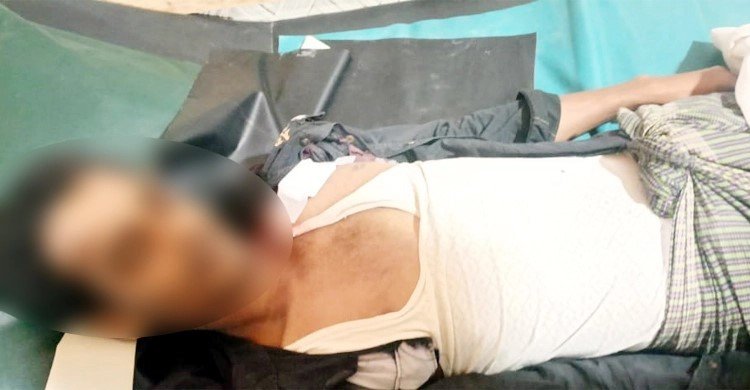পাওনা টাকা নিয়ে দ্বন্দ্বে ছুরিকাঘাতে রোহিঙ্গা খুন