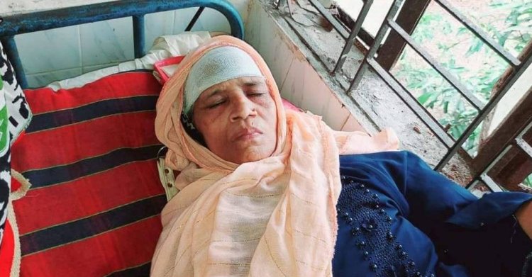 ছেলের বিরুদ্ধে হাতুড়ি দিয়ে মাকে পেটানোর অভিযোগ