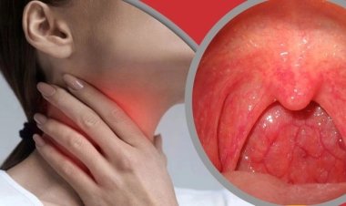 গরমে গলাব্যথা হলে সারাবেন যেভাবে