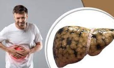 লিভারে চর্বি জমেছে কি না বুঝবেন যে লক্ষণে