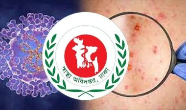 `মাঙ্কিপক্স' নিয়ে দেশের সব বন্দরে সতর্কতা