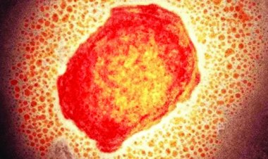 মাঙ্কিপক্স বিস্তারে, আতঙ্কে ইউরোপ