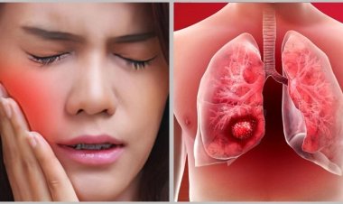 ফুসফুসের ক্যানসারের যে লক্ষণ ফুটে ওঠে মুখে