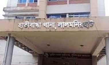  শ্বশুরের দেওয়া অ্যাসিডে ঝলসে গেল পুত্রবধূর শরীর