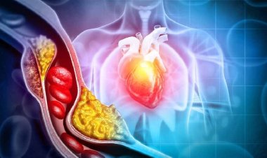 কোলেস্টেরল জব্দ হবে এক পানীয়ে! বানানোর কায়দা জেনে নিন