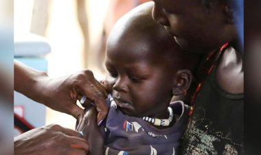  জিম্বাবুয়েজুড়ে হামের প্রাদুর্ভাব, ১৫৭ শিশুর মৃত্যু