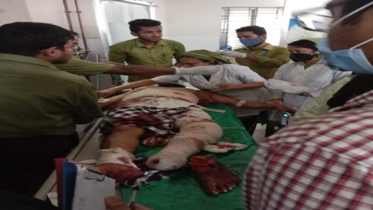 মঠবাড়িয়ায় দুর্বৃত্তদের কোপে জাপা নেতার পা বিচ্ছিন্ন