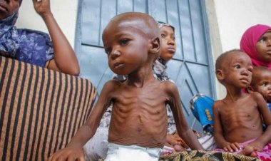  অপুষ্টিতে সোমালিয়ায় হাজারো শিশুর মৃত্যু হতে পারে 