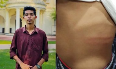 রুম পরিবর্তনে দেরি করায় ঢাবি শিক্ষার্থীকে রড দিয়ে পেটাল ছাত্রলীগ