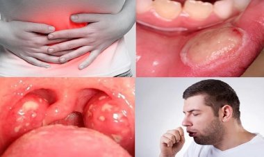 শরীরে ক্যানসার আছে কি না বুঝে নিন লক্ষণ দেখেই