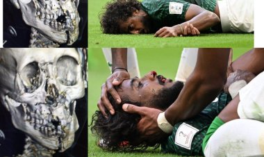চোয়াল এবং মুখের হাড় ভেঙে গেছে সৌদি ফুটবলারের