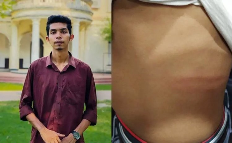 রুম পরিবর্তনে দেরি করায় ঢাবি শিক্ষার্থীকে রড দিয়ে পেটাল ছাত্রলীগ