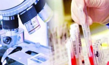 মুখ থুবড়ে পড়েছে চালকদের ডোপ টেস্ট