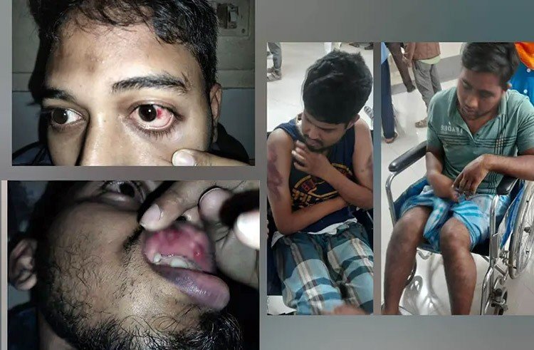 শিবির সন্দেহে চমেক হোস্টেল থেকে ধরে নিয়ে ৪ ছাত্রকে রাতভর অমানবিক নির্যাতন