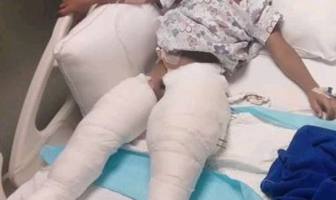 পা হারানো শিশু অগ্ররাজ হাসপাতালে  আজীবন পুনর্বাসনের দাবিতে মানববন্ধন