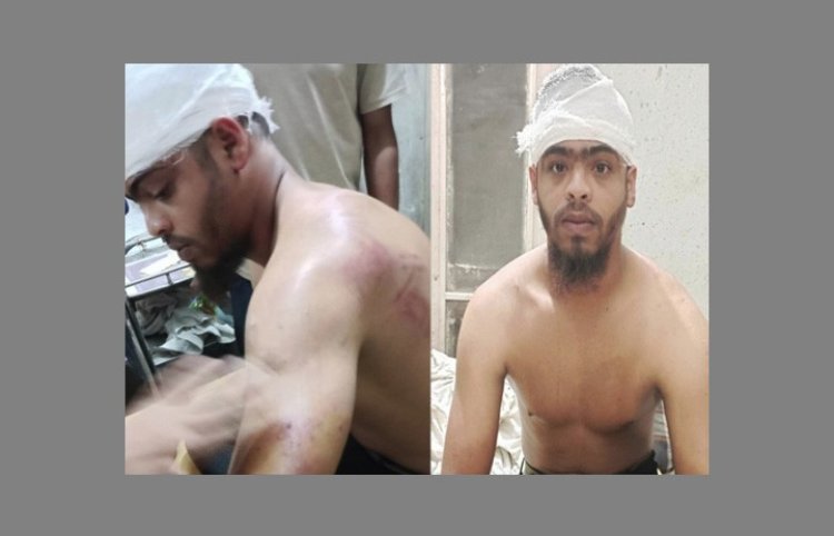 আড়াইহাজারে আ’লীগের সন্ত্রাসীরা যুবককে পিটিয়েছে