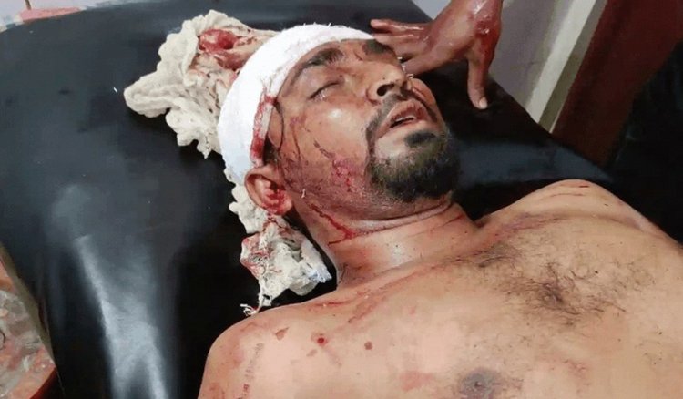 আড়াইহাজারে সন্ত্রাসীদের তান্ডব : যুবদল নেতাকে পিটিয়ে ও চোখ তুলে হত্যা : গ্রেপ্তার-২