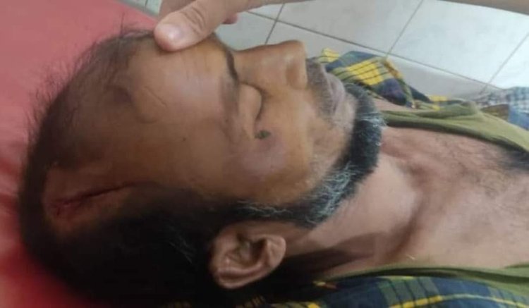 ভাতিজার লাঠির আঘাতে চাচার মৃত্যু