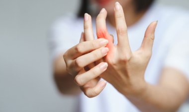 বাতের ব্যথা কমাতে যে ৫ খাবার খাবেন