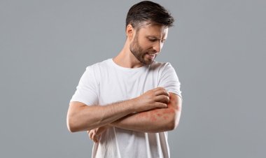 অ্যালার্জির সমস্যায় যে খাবারগুলো এড়িয়ে চলবেন