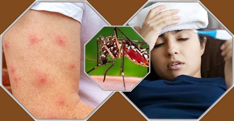 এডিস মশা কখন কামড়ায়, চিনবেন কীভাবে?