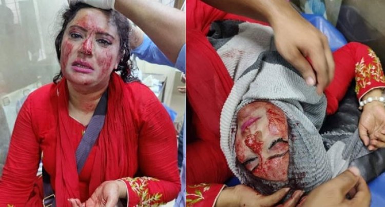 উত্তরায় হামলায় মাথা ফেটে গেছে মহিলা দলের নেত্রী নিলুর
