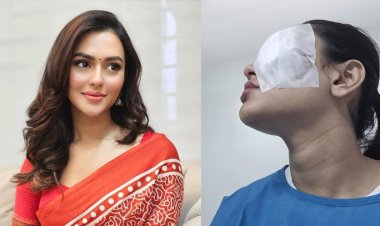নুসরাত ফারিয়ার চোখে অস্ত্রোপচার