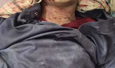 নোয়াখালীতে মাদরাসার ছাদ থেকে পড়ে শিক্ষার্থীর মৃত্যু