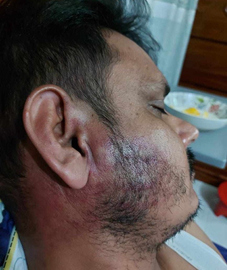 সরিষাবাড়ীতে চাঁদা না দেয়ায় ব্যবসায়ীকে পিটিয়েছে এমপি’র ক্যাডার বাহিনীঃ থানায় অভিযোগ