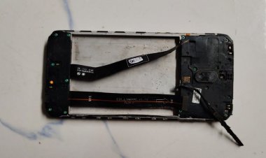  মোবাইলের ব্যাটারি বিস্ফোরণে পুড়ল যুবকের বুক