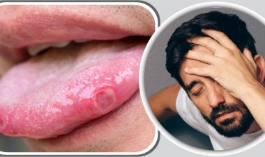 মাথা ঘোরা-জিহ্বায় ঘা হতে পারে যে ভিটামিন ঘাটতির লক্ষণ