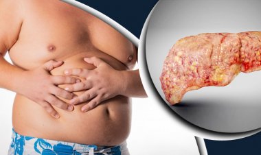 ফ্যাটি লিভার সারাতে কাজ করে রান্নাঘরের যে উপাদান