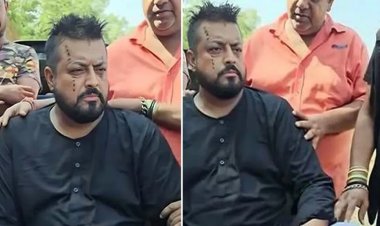 শুটিং সেটে সাপের কামড়ে আহত ওমর সানী