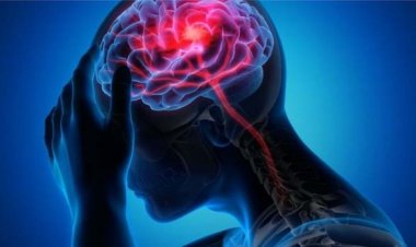 স্ট্রোক : যেসব পদক্ষেপ রোগীর জীবন বাঁচাতে পারে