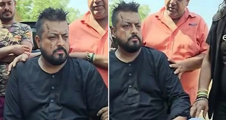 শুটিং সেটে সাপের কামড়ে আহত ওমর সানী