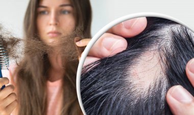 যে ৭ কারণে চুল পড়ে, সমাধানে যা করবেন