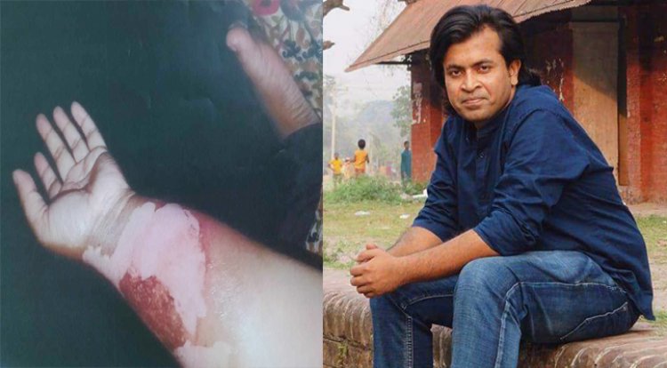 পরকীয়া জেনে যাওয়ায় স্ত্রীকে ঝলসে দেন চবি শিক্ষক