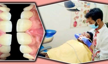  সামনের ফাঁকা দাঁত, সমস্যা সমাধানের উপায়