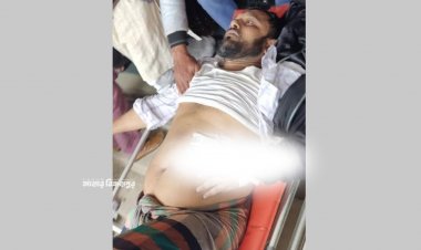 পিস্তল নাড়াচাড়া করতে গিয়ে ব্যবসায়ী গুলিবিদ্ধ