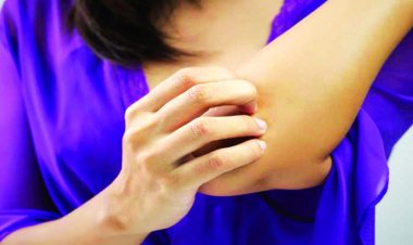 খোসপাঁচড়া রোগ হলে যা করবেন 